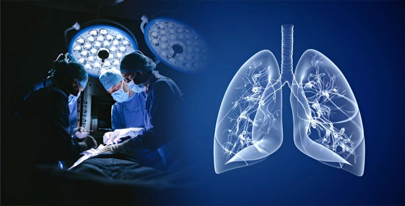 Stem Cell Therapy for Pulmonary Disorders in India