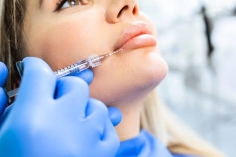 The Evolution and Benefits of Dermal Fillers in Leeds