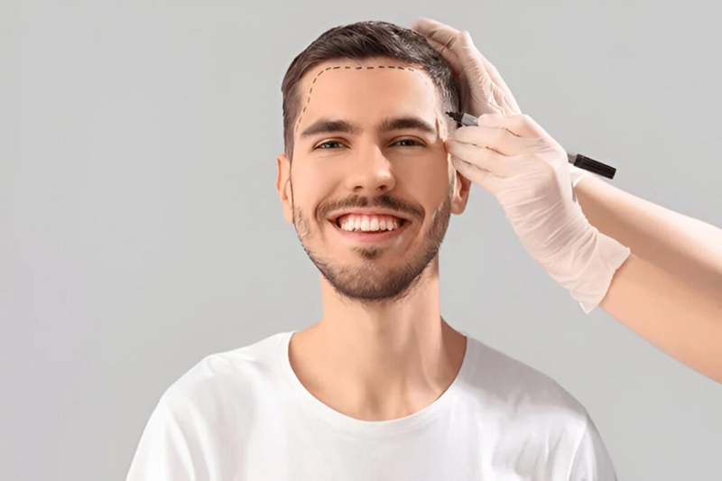 The Ultimate Guide to Hair Transplants in Delhi Costs Techniques Doctor Insights You Must Know