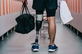 Limb Prosthetics Market Growth, Future Prospects & Competitive Analysis, 2022 – 2030