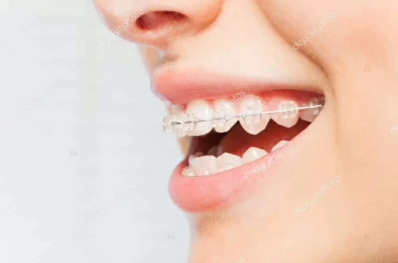 Teeth Whitening in Downtown Oakville: Revitalize Your Smile with a Radiant Shine