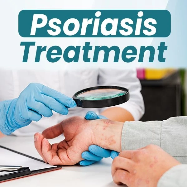 5 Best Permanent Solution for Psoriasis 