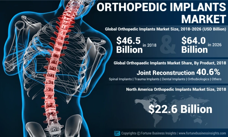 Orthopedic Implants Market Size Analysis, Share, Growth Potential to 2026