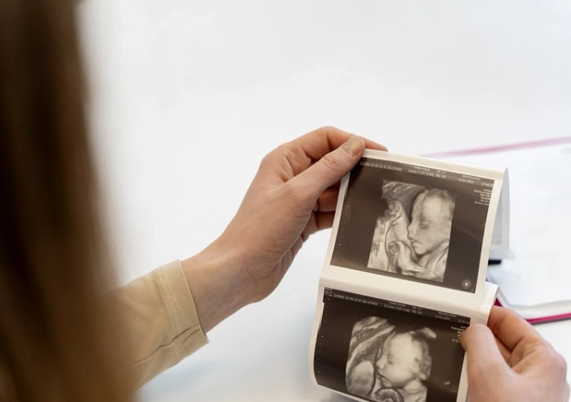 What Is 4d Sonography In Pregnancy?