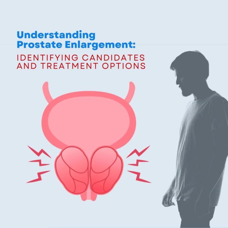 Understanding Prostate Enlargement: Identifying Candidates and Treatment Options