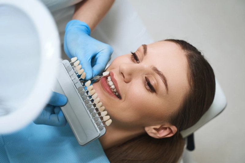 Dental Veneers Boca Raton, Dentist Boca Raton: A Complete Guide to a Confident Smile