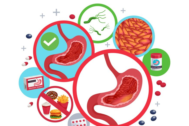 The Digestive Power of Bile Acid Metabolites