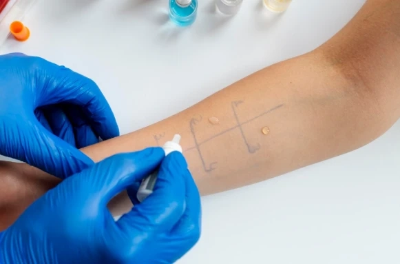 Lyme Symptom Checker: How Early Detection Tools Are Helping UK Patients Identify Hidden Lyme Disease in 2025