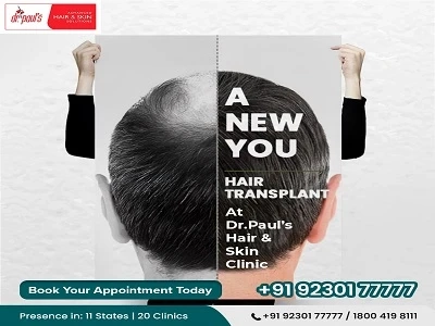 Transform Your Look with Advanced Acne Scar Treatment and the Best Hair Transplant Clinic in Kolkata