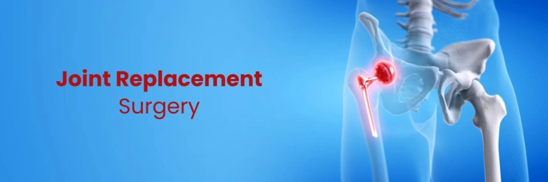 Comprehensive Guide to Joint Replacement Surgery Surgery in Delhi