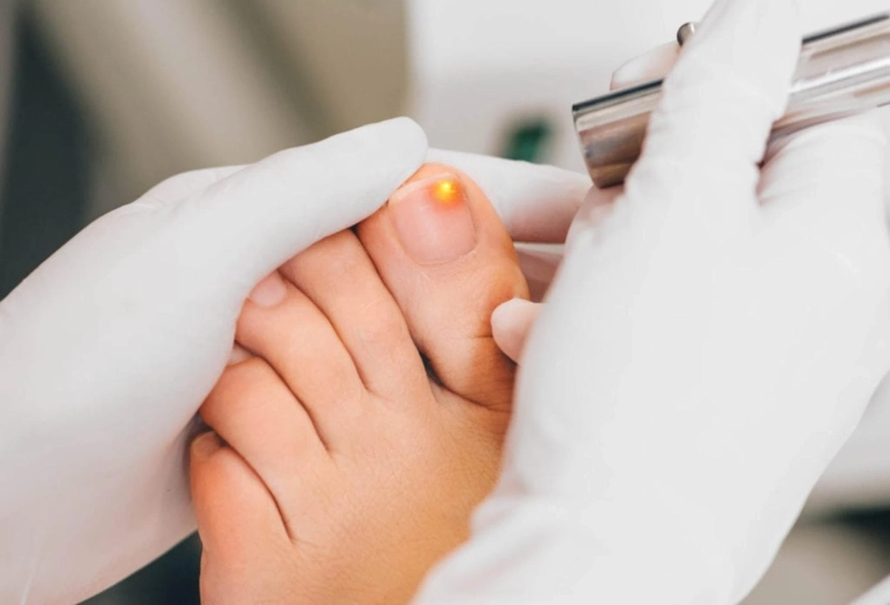 Onychomycosis Treatment Market 2023: Size, Share, Growth, Analysis and Forecast 2028