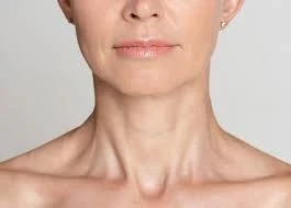 What Do You Need to Know About Botox Neck Lift?