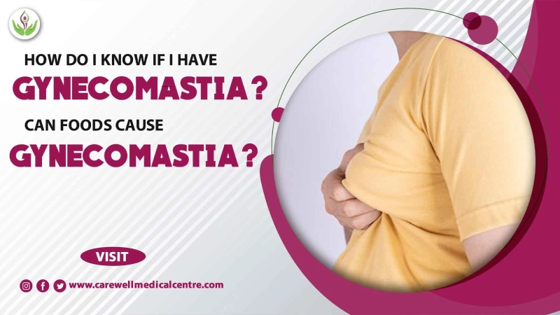 How do I know if I have Gynecomastia? Can Foods Cause Gynecomastia?