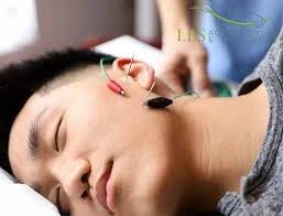 Workinprogressacu.com Reveals How To Choose The Best Acupuncturist For You