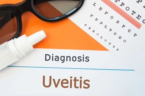 Uveitis Market Report 2020: Top Players Countries Type and Application Regional Forecast To 2030