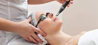 Say Goodbye to Skin Imperfections with Pico Laser Treatment