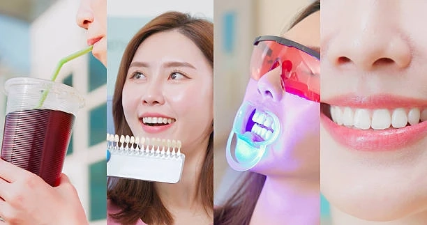 Teeth Whitening Guide: Methods, Safety, and What Actually Works