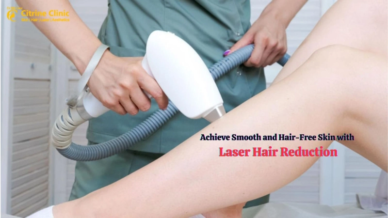 Achieve Smooth and Hair-Free Skin with Laser Hair Reduction