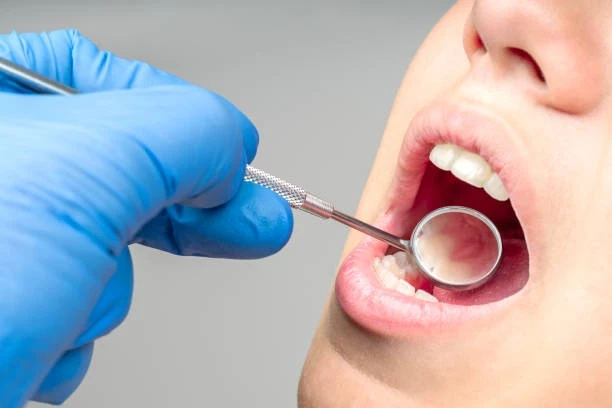 Preventive Dentistry: The Key to Avoiding Costly Dental Treatments