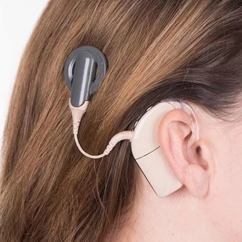 Implantable Hearing Device Market Insight | Outlook | Growth Analysis Report 2028