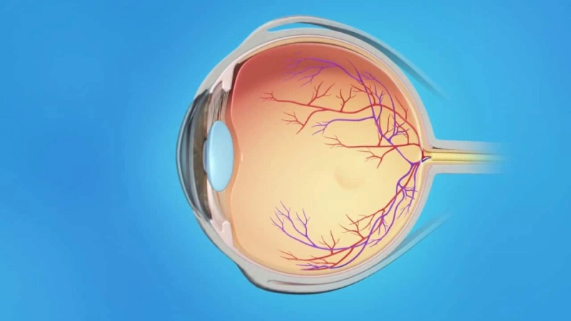 Diabetic Retinopathy Market Size, Share, Growth, Outlook, and Opportunity Analysis, Forecast 2019 - 2027