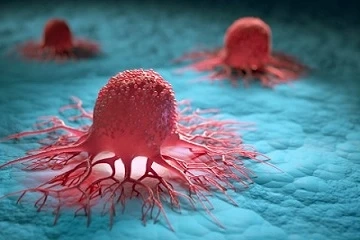 USA Solid Tumor Therapeutics Market expected to reach $150 billion by 2028