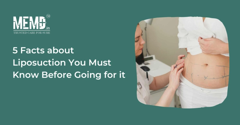 5 Facts About Liposuction You Must Know Before Going For It