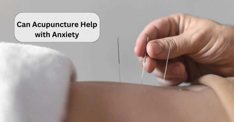 Does Acupuncture Provide Relief from Anxiety?