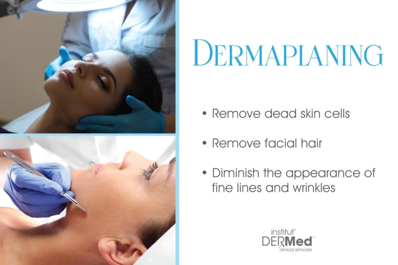 What to Expect From Your First Dermaplaning Session
