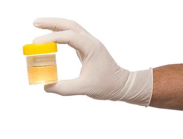 Everything You Need to Know About Stinger Detox: An In-Depth Review