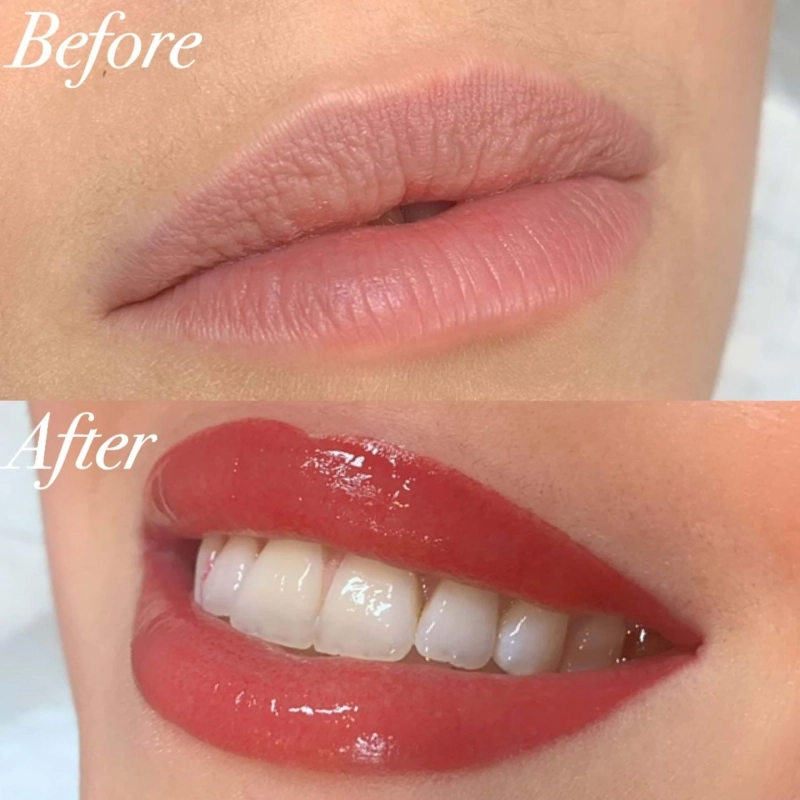 How can I have pink lips or get out of my dark lip?