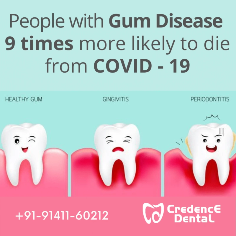 Gum Disease link to COVID-19 Complications