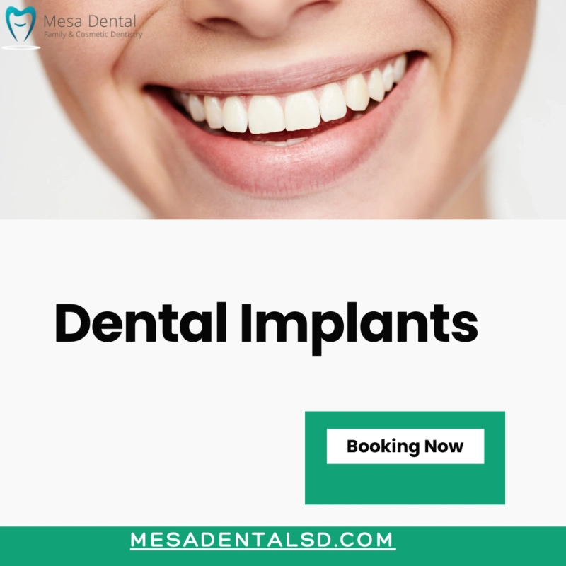 Dental Implants for a Stronger Bite and Healthier Smile