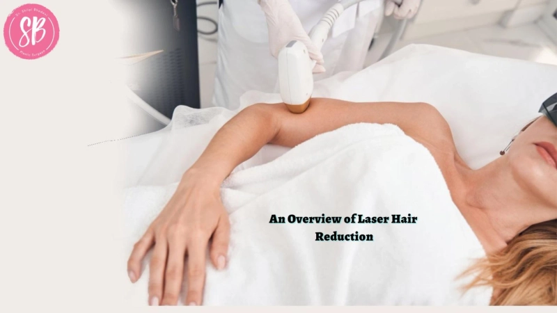 An Overview of Laser Hair Reduction
