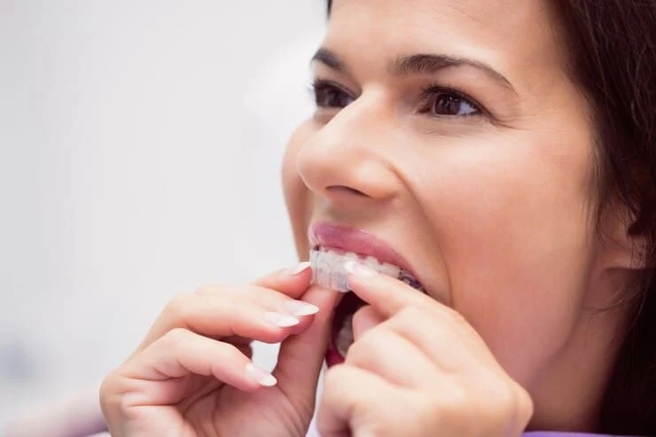 Invisalign Dentist Union City for Comfortable Teeth Straightening