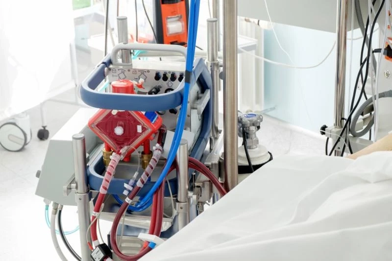 Global Extracorporeal Membrane Oxygenation Machine Market 2022 Share, Size, Trend, Market Analysis and Forecast to 2027
