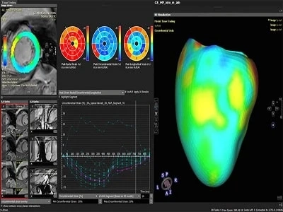 India Cardiac Medical Imaging Software Market to Establish Growth with Higher Investments Until FY2027 | TechSci Research