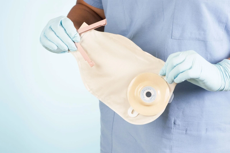 In the aftermath of surgery, Ostomy Care assists patients in recovering and readjusting back to normal lifestyles