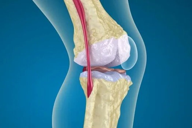 Why Ayurvedic Treatment Is The Best Solution For Orthopedic Problems
