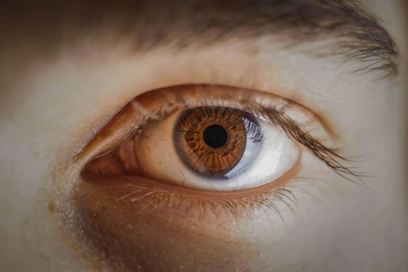 Different types of Sore Eyes and how to treat it