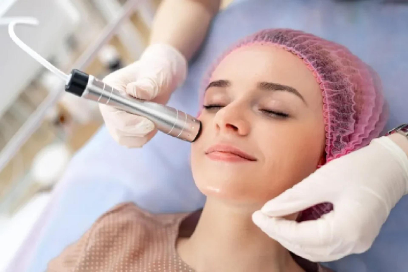 What Happens During a Microdermabrasion Session?