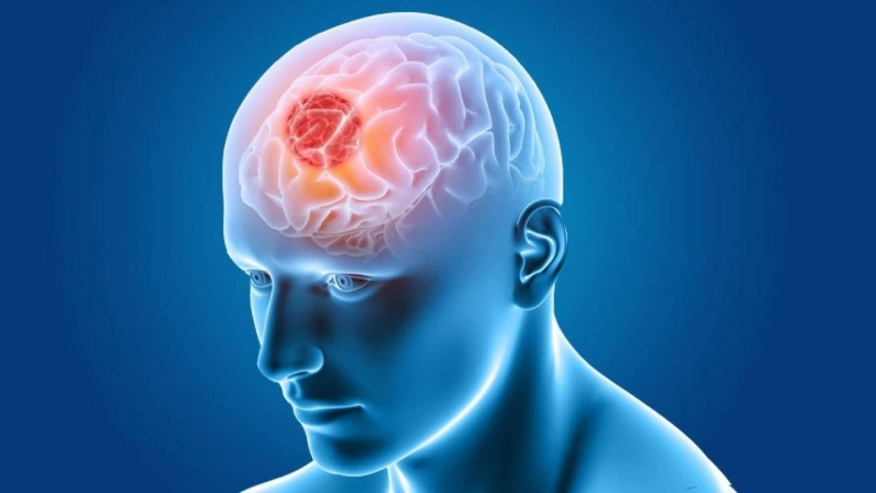 Brain Tumor Surgery in India