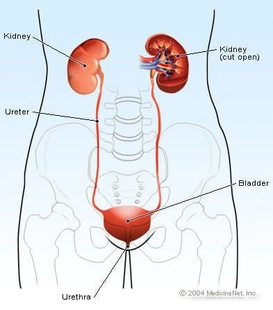 How to pass the kidney stone easily?