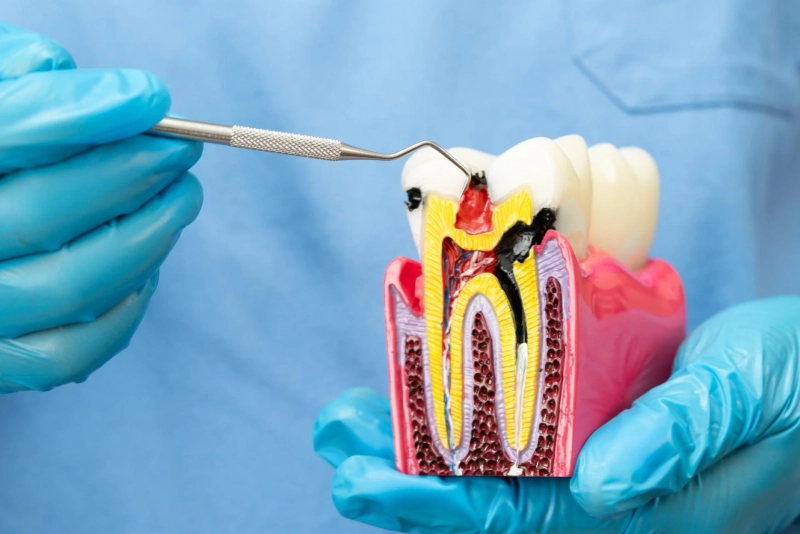Bacterial Buildup Around Implants: Understanding Swelling and Effective Solutions