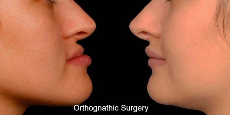 Best Dentist in Pune