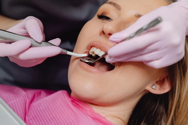 Oral Appliances and the Treatment of Obstructive Sleep Apnea
