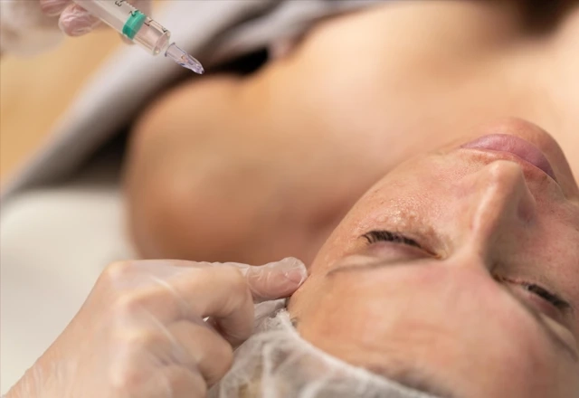 Is Mesotherapy Suitable for All Skin Types Now?