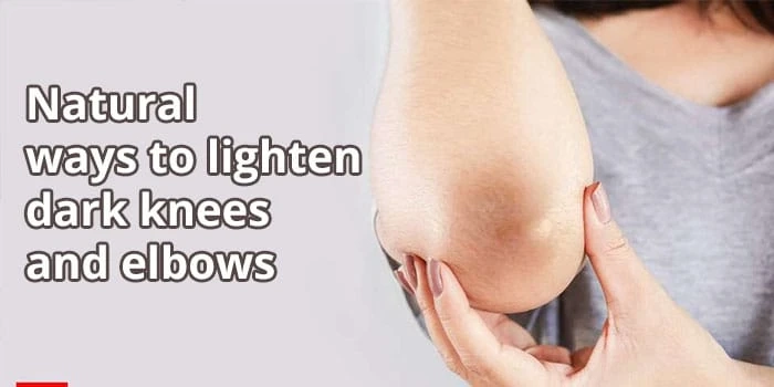 What is the most effective method for getting rid of black elbows and knees?