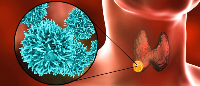 Recurrent or Metastatic Head and Neck Cancer Drug Pipeline Analysis Report 
