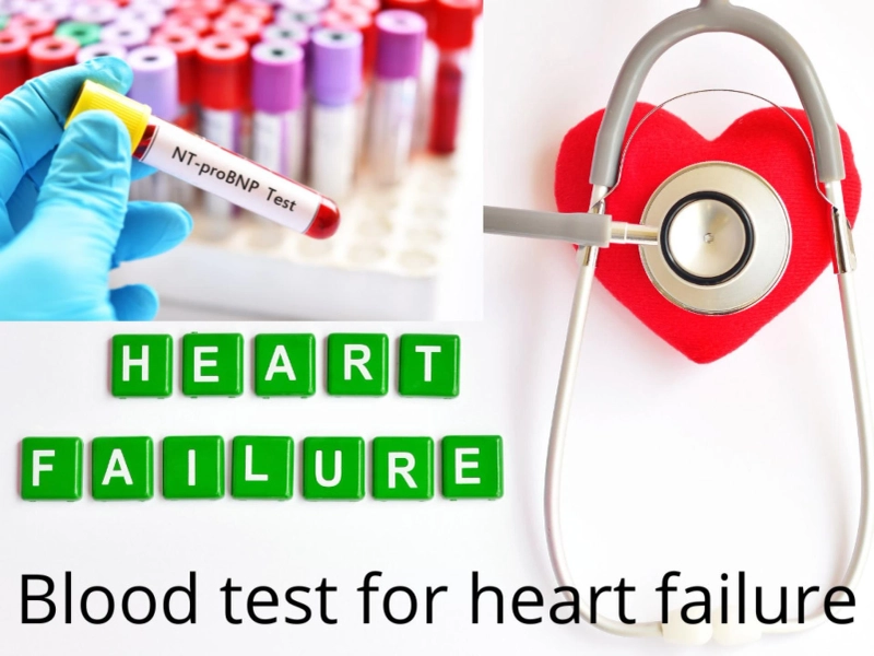 Blood tests to diagnose heart failure?